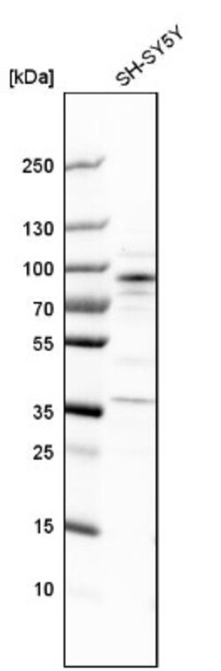 ARHGEF7 Antibody, Novus Biologicals 25 &mu;L; Unlabeled:Antibodies, Polyclonal